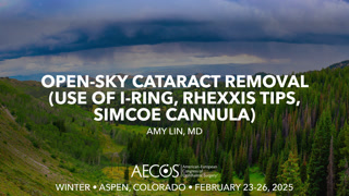 Open-sky cataract removal (use of I-ring, rhexxis tips, Simcoe cannula)